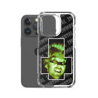 Inverted David iPhone Case